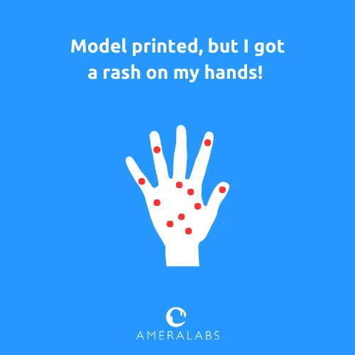 Model printed, but I got a rash on my hands. A rash on the skin, sore eyes, or throat due to sensitivity from repetitive exposure to resin or resin fumes.