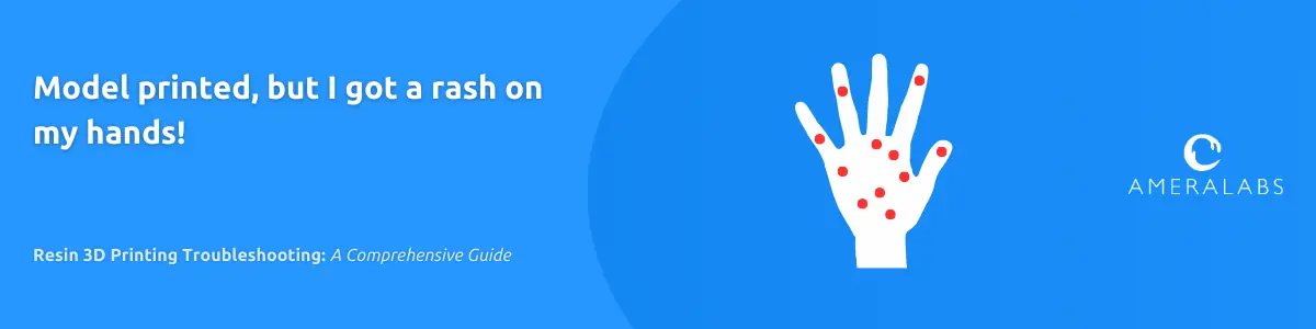 Model printed, but I got a rash on my hands! If there is a rash on your skin, or you get sore eyes or throat, you might have gotten sensitive to resin. That can happen due to repetitive exposure through touch or resin fumes. Resin 3D printing materials are known to cause irritation. Treat these materials and take all safety precautions with utmost respect and seriousness. Each case might be different, but these are the first steps to take.